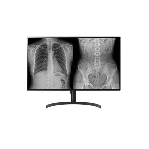 Monitor komputerowy LG 32HL512D-B 80 cm 3840 x 2160 px Full HD Czarny